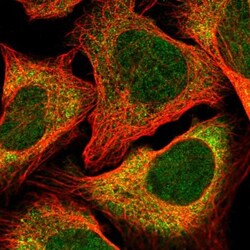 CLNS1A Antibody, Novus Biologicals 0.1mL; Unlabeled:Antibodies, Polyclonal